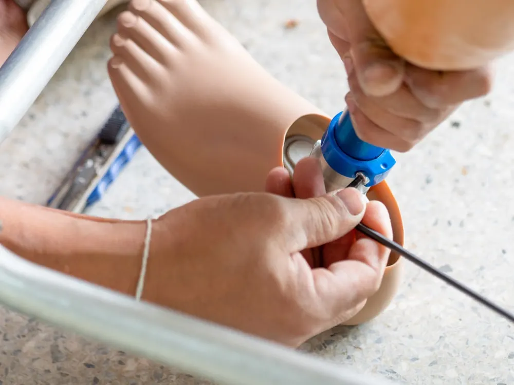 What is the difference between an orthotist and a prosthetist?